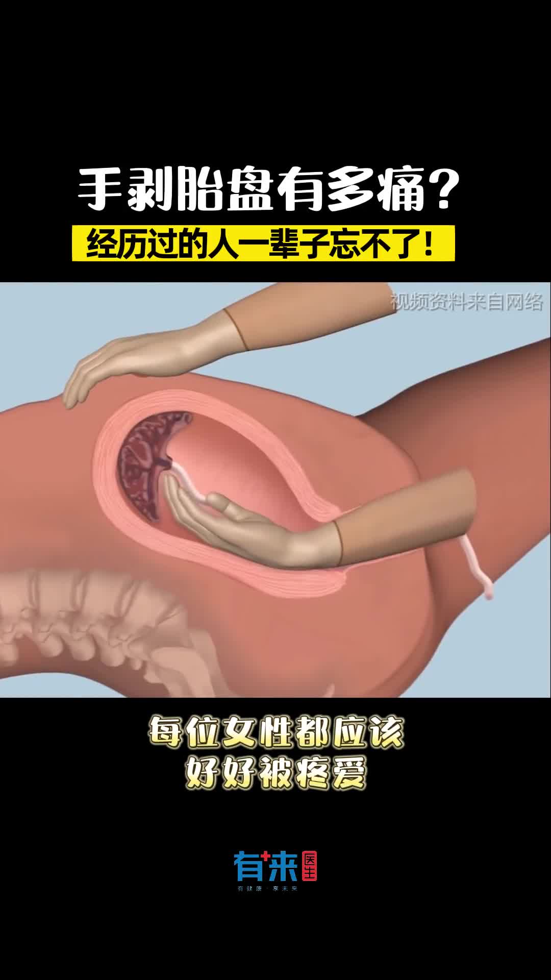 不就是生个孩子嘛希望你们都看看吧