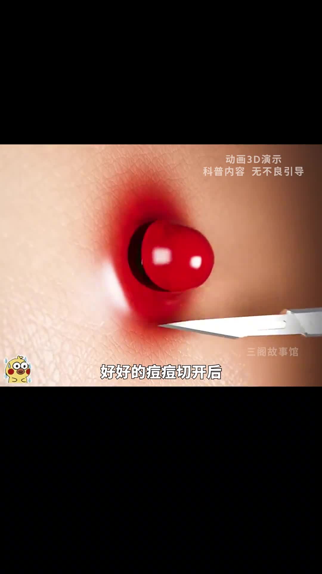 你被头发攻击过吗