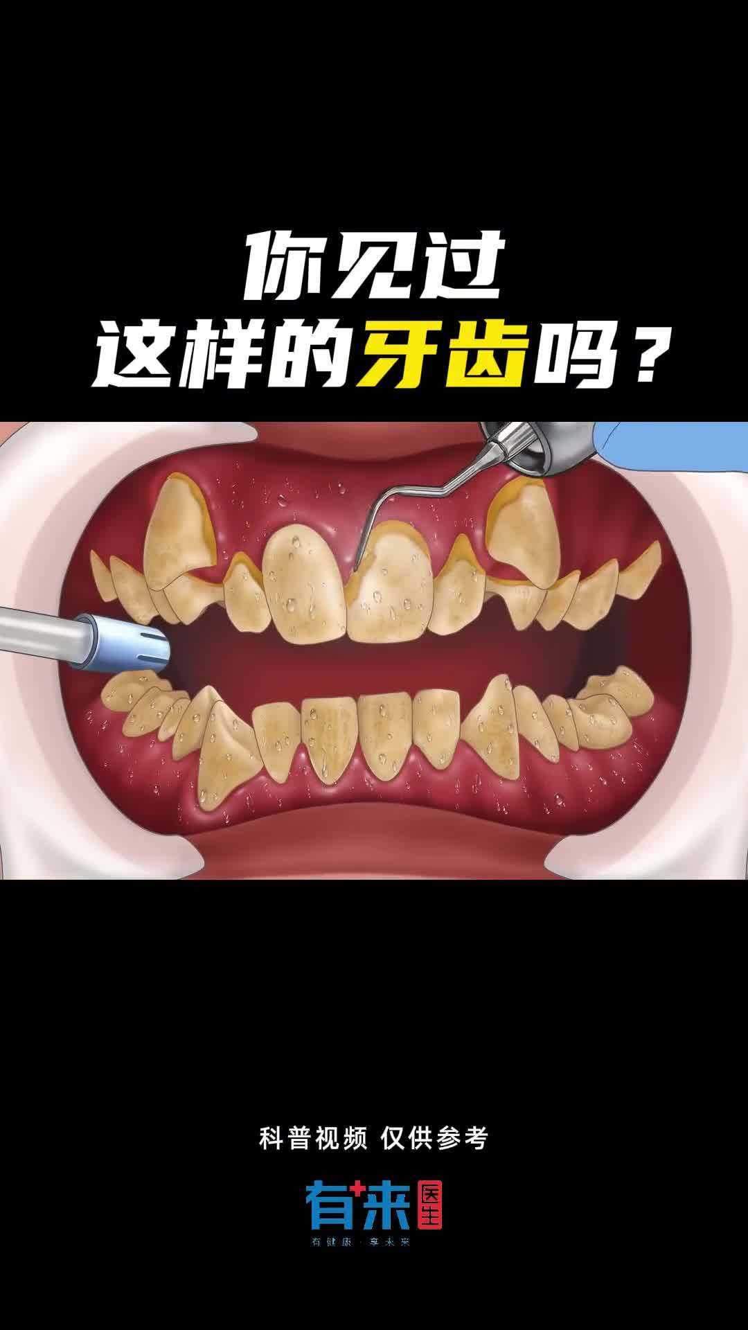 你身边有人是这样的牙齿吗