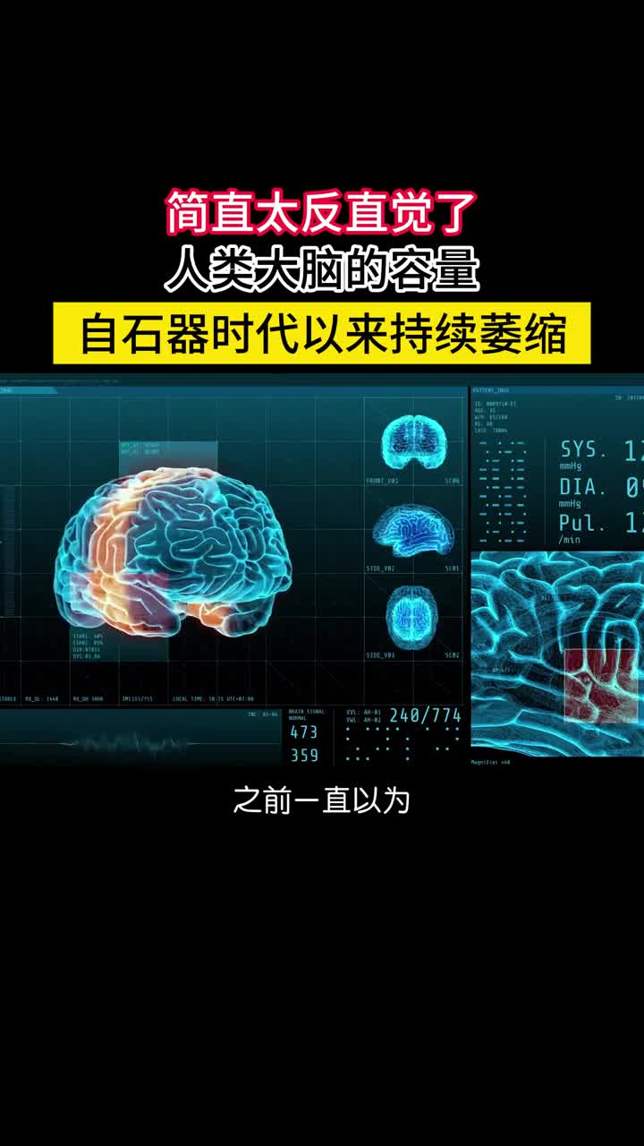 太可怕了人类的脑容量自石器时代以来竟然一直在减小一直以为随着科技的进步人类的肢体功能或许会退化但大脑肯定越来越强大但事实恰恰相反科学家发现人类的脑容量巅峰不是现代而是旧石器时代末期现代成年人的平均脑容量比石器时代减小了100毫升