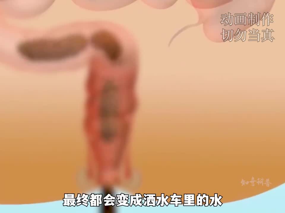 你拉出来的便便最终变成了洒水车里的水