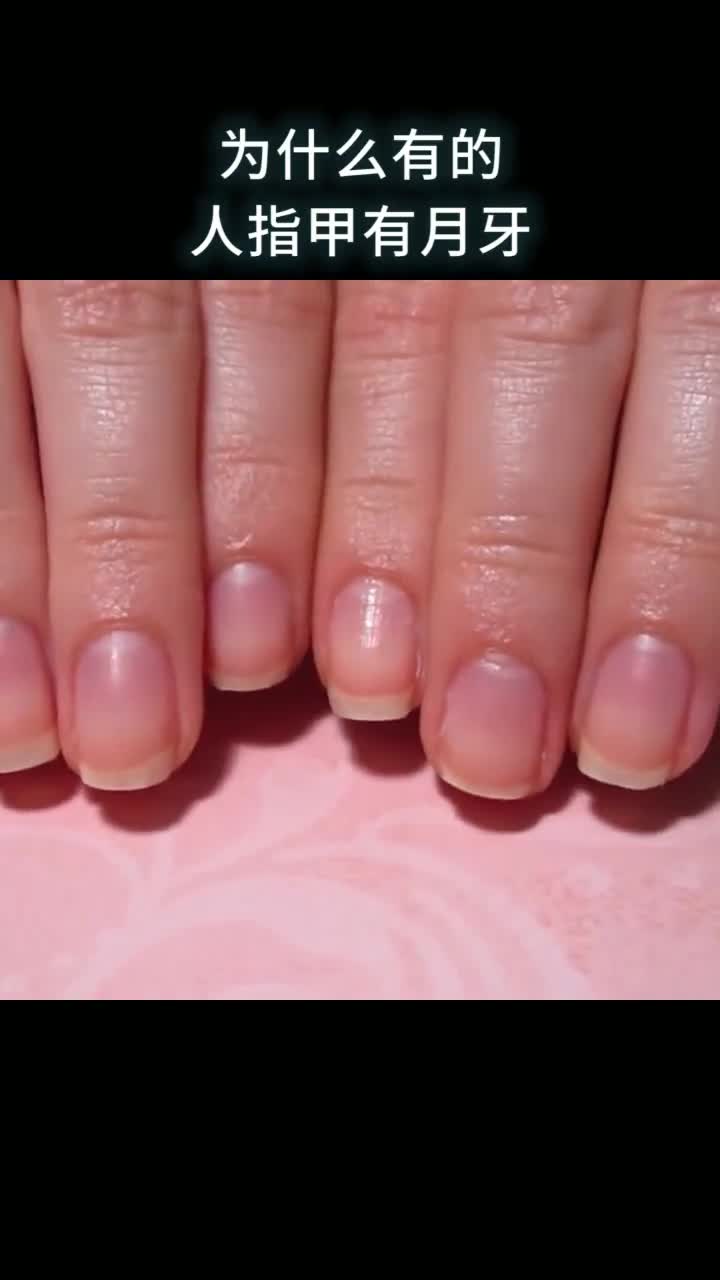 为什么有的人指甲有月牙有的人却没有
