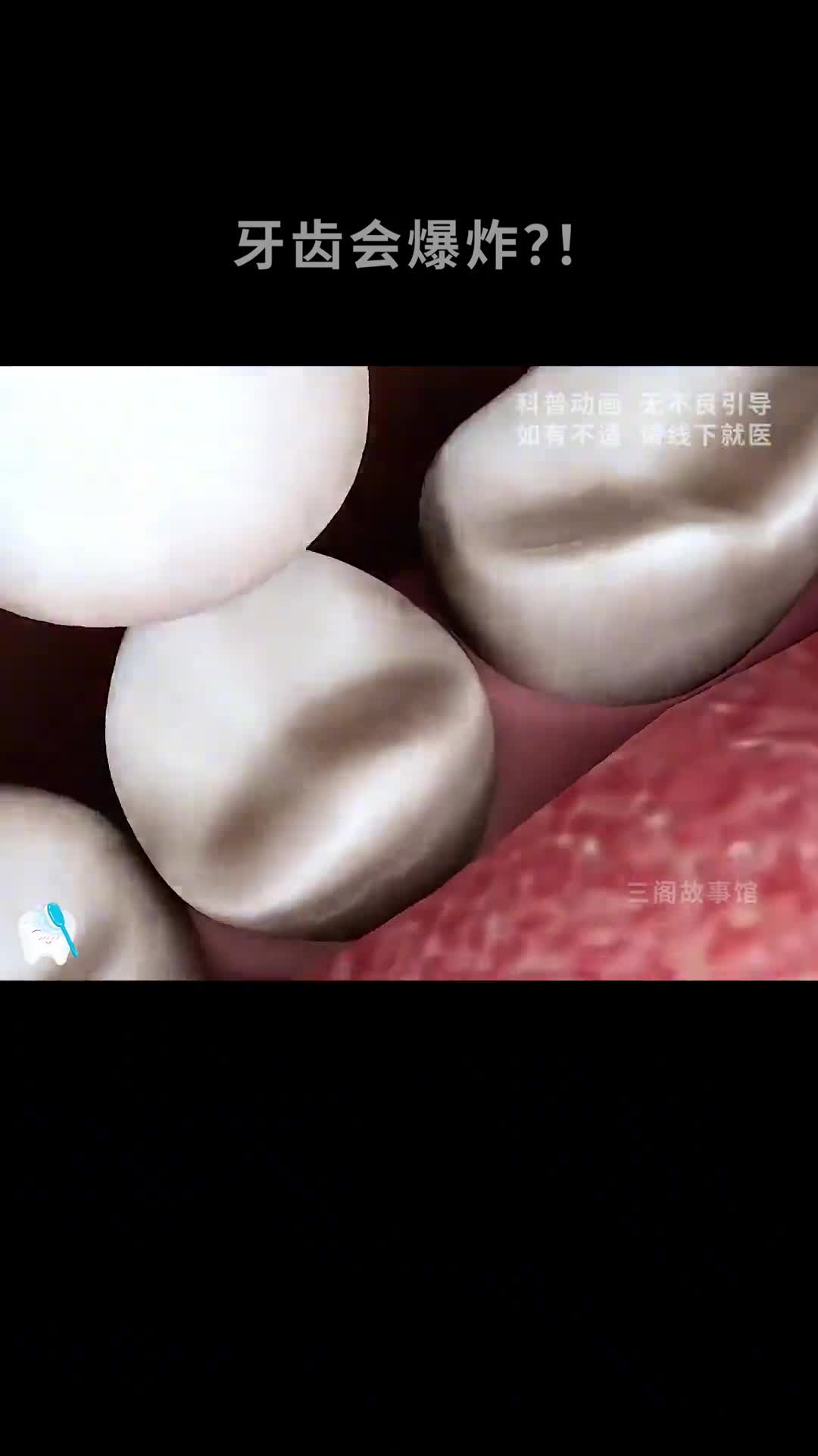 牙齿居然会爆炸