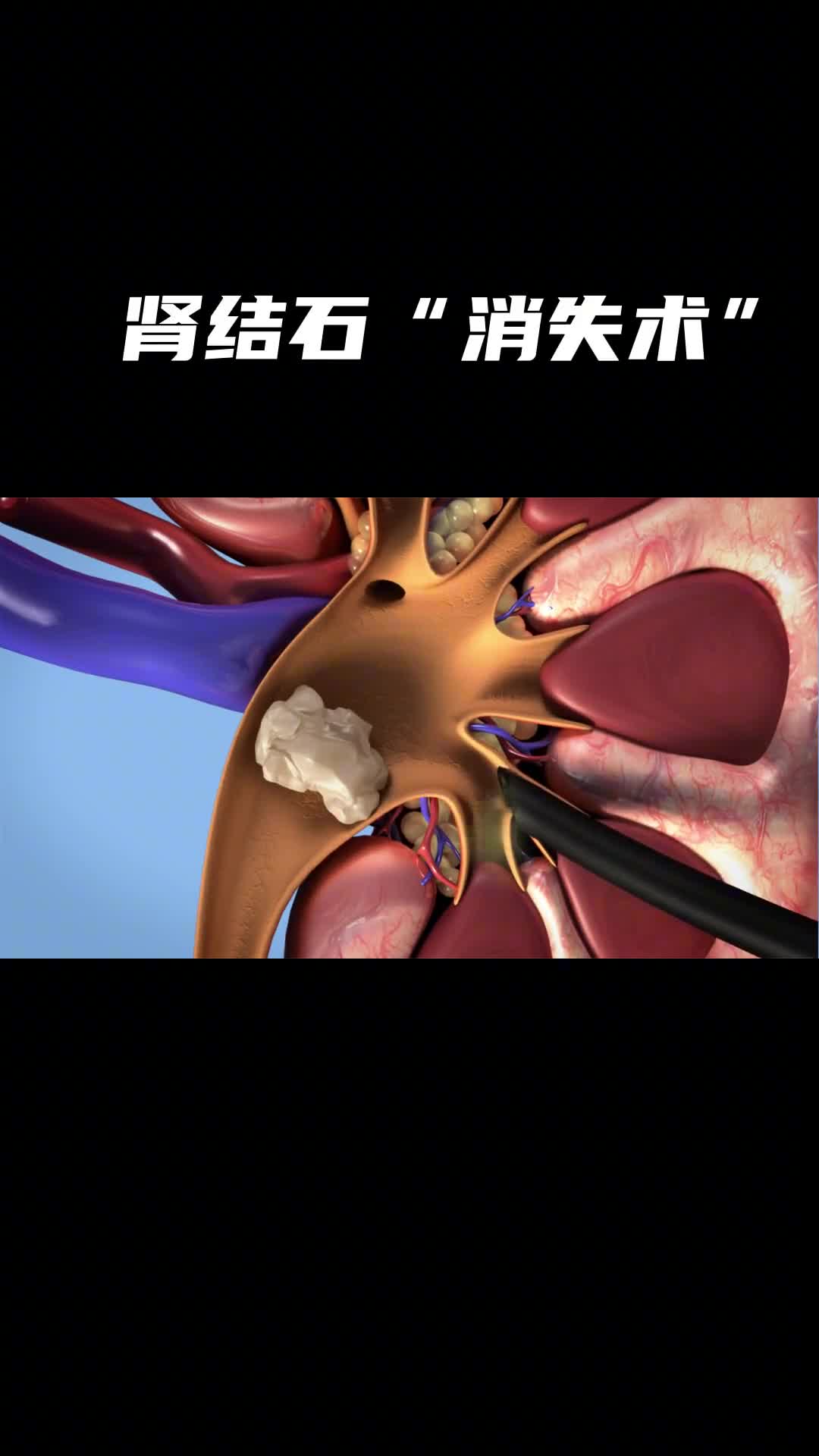 看到消失的小石头非常解压