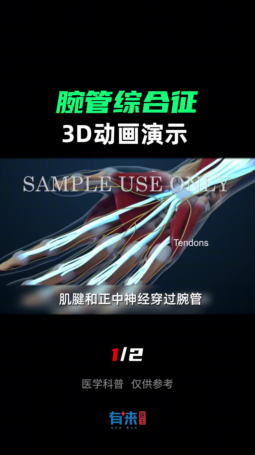 你的手也会突然使不上力吗