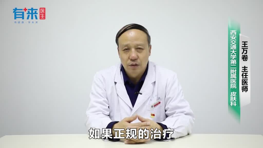 银屑病自愈的几率