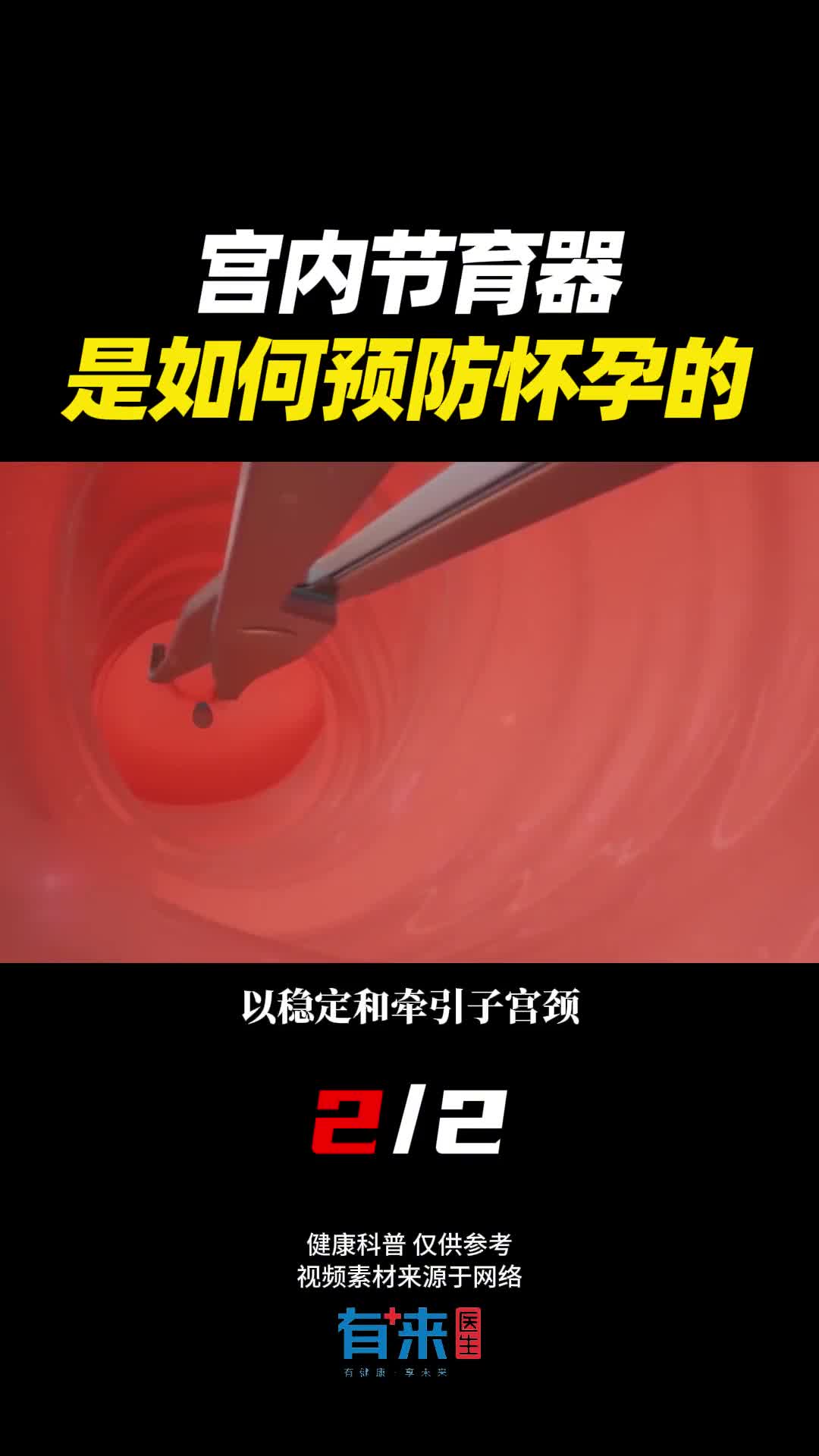 原来是这么操作的