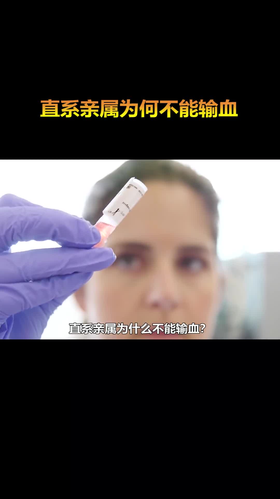 直系亲属为什么不能输血