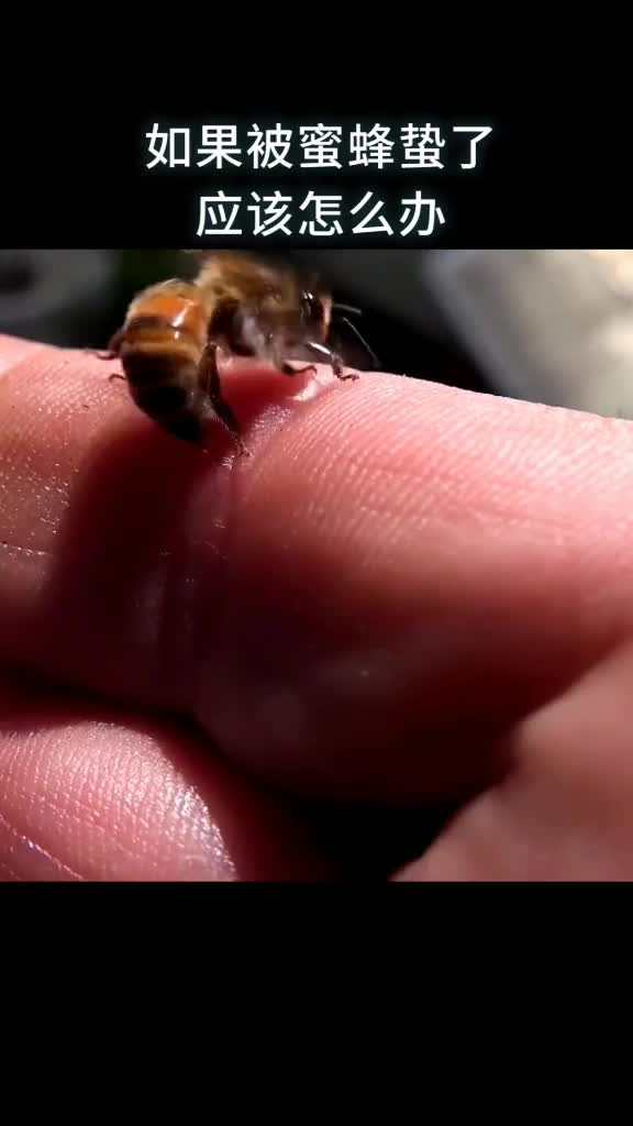 如果被蜜蜂蛰了应该怎么办