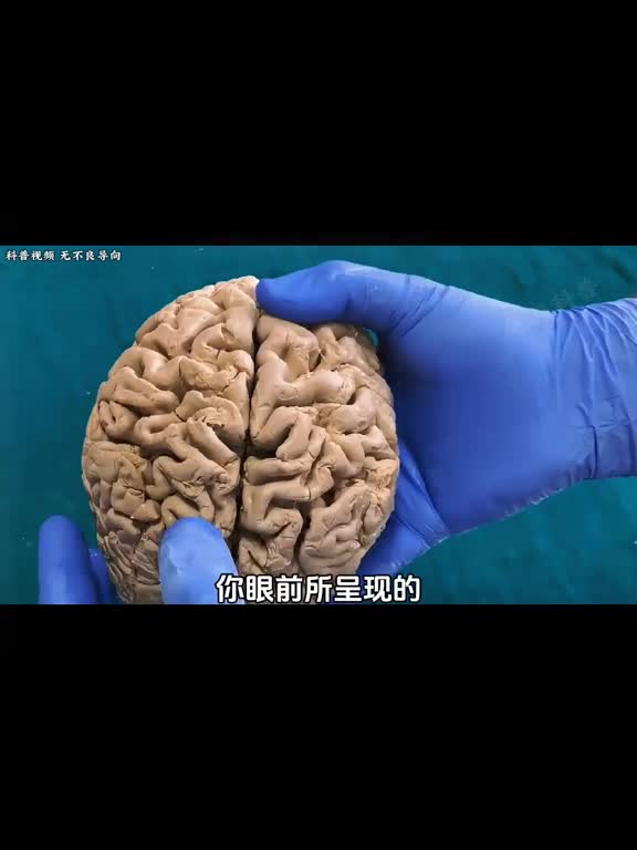 大脑结构大脑的内部结构究竟是怎样的它又是如何令人产生思想的