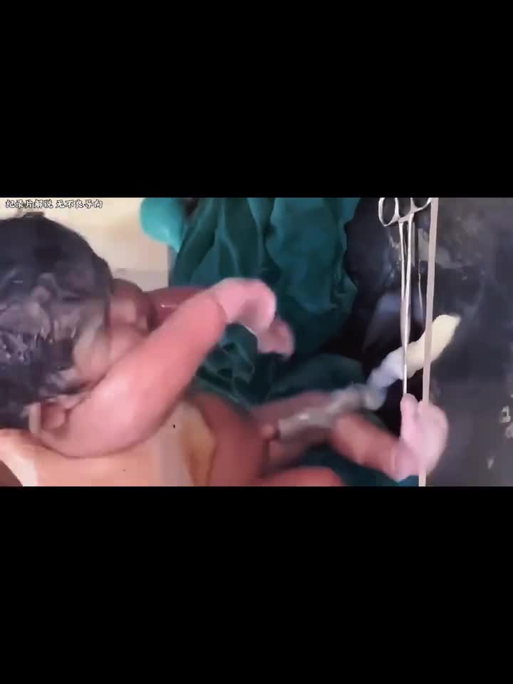 抢救新生儿宝宝刚出生就没有了呼吸医生正在全力抢救是否会有奇迹发生