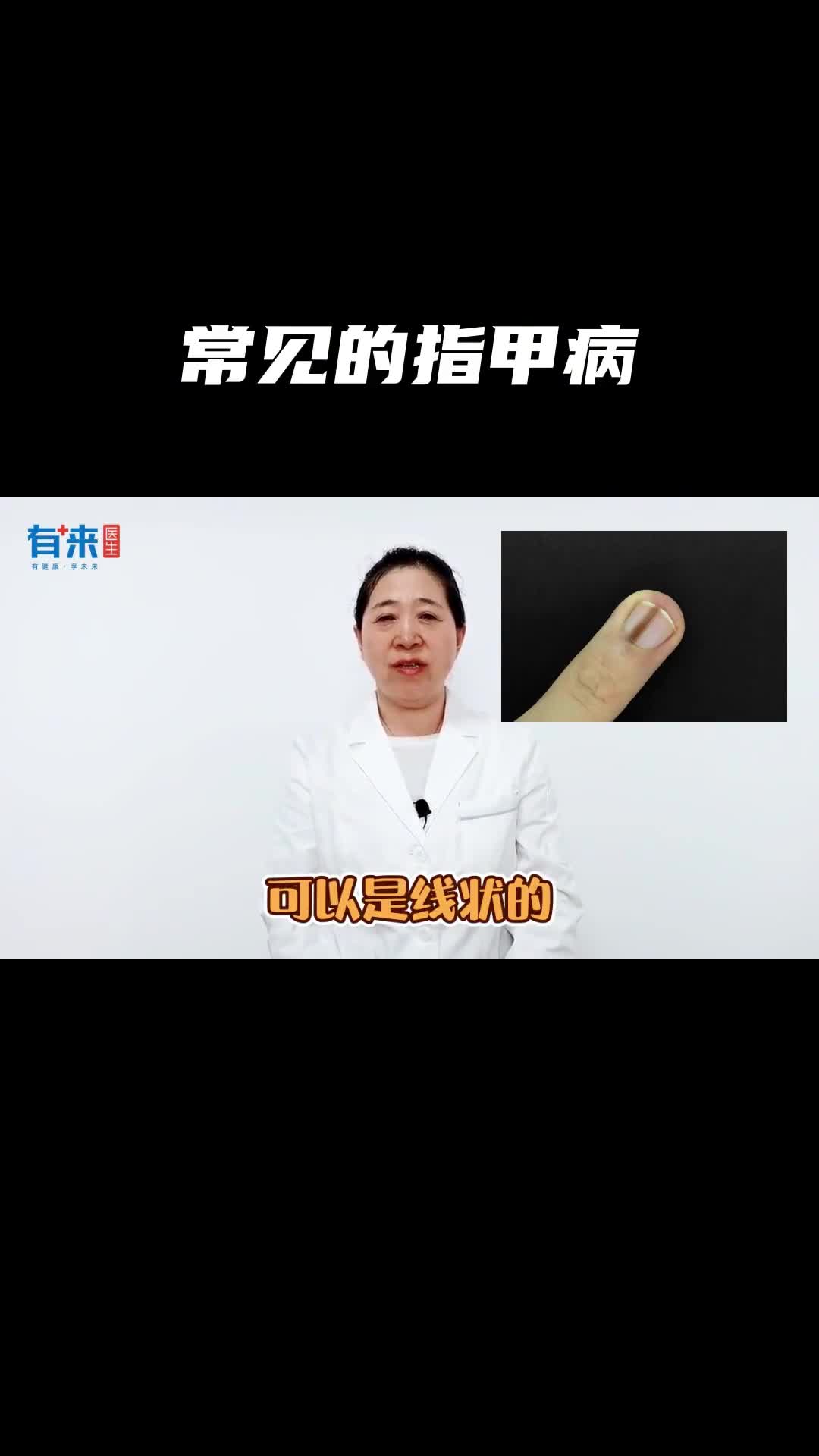 看看你的指甲有问题吗