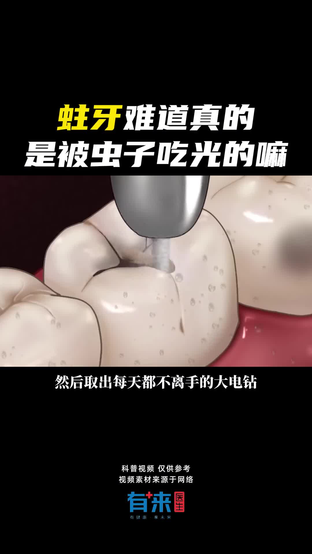 你为什么会得蛀牙