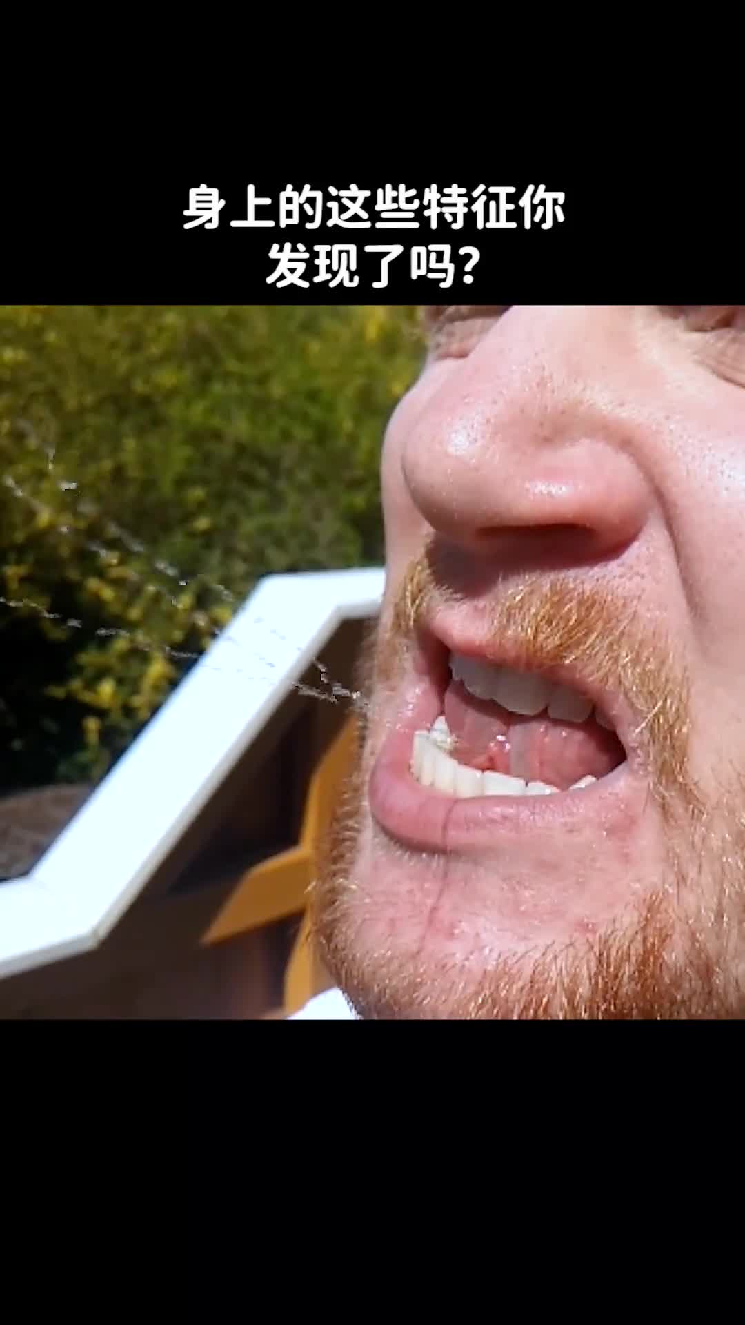 身上的这些特征你发现了吗