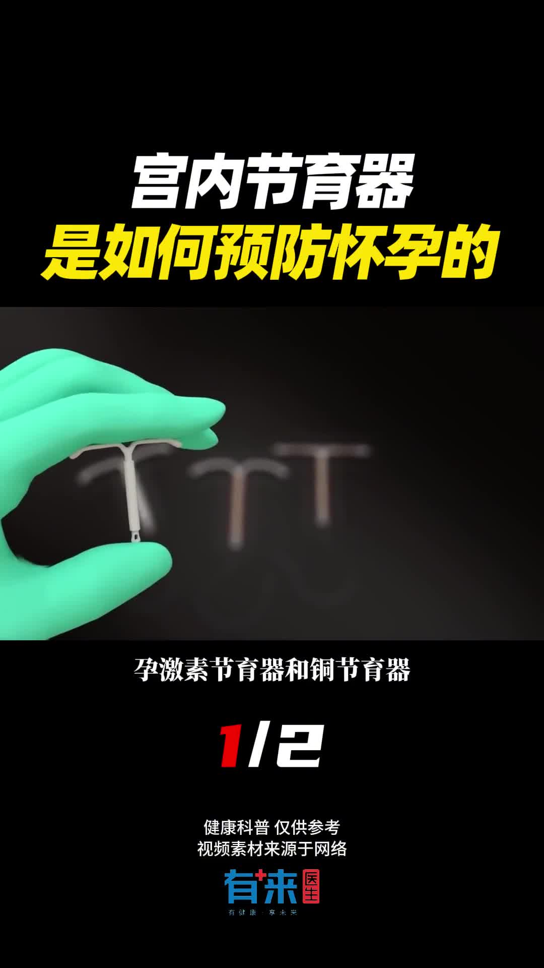 节育器是如何发挥作用的