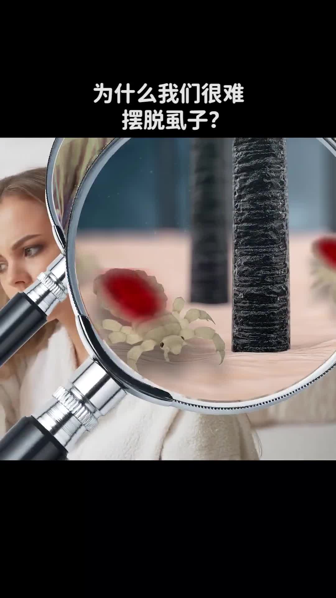 为什么我们很难摆脱虱子