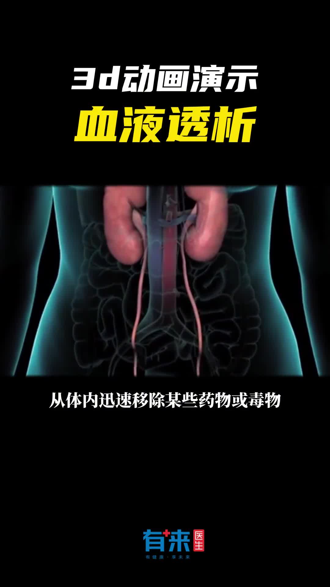 你了解血液透析是如何操作的吗