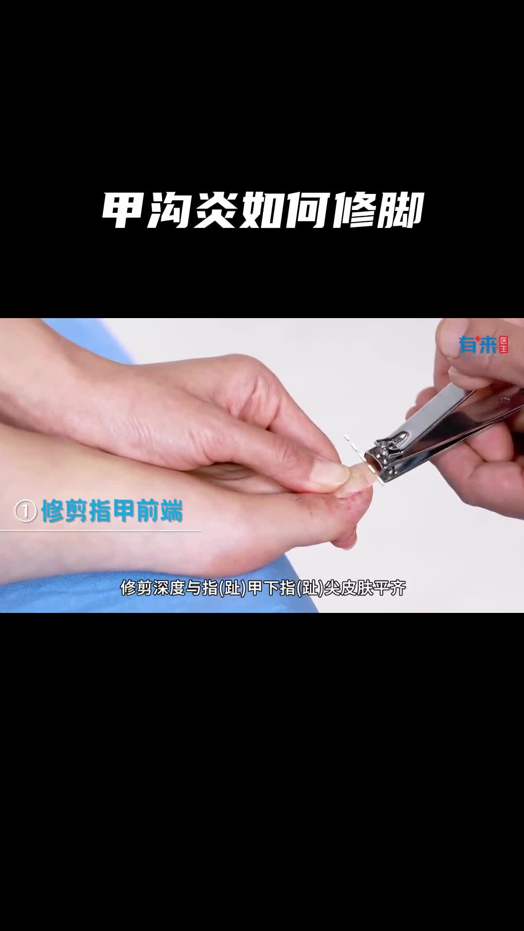 甲沟炎如何修脚跟着视频学起来