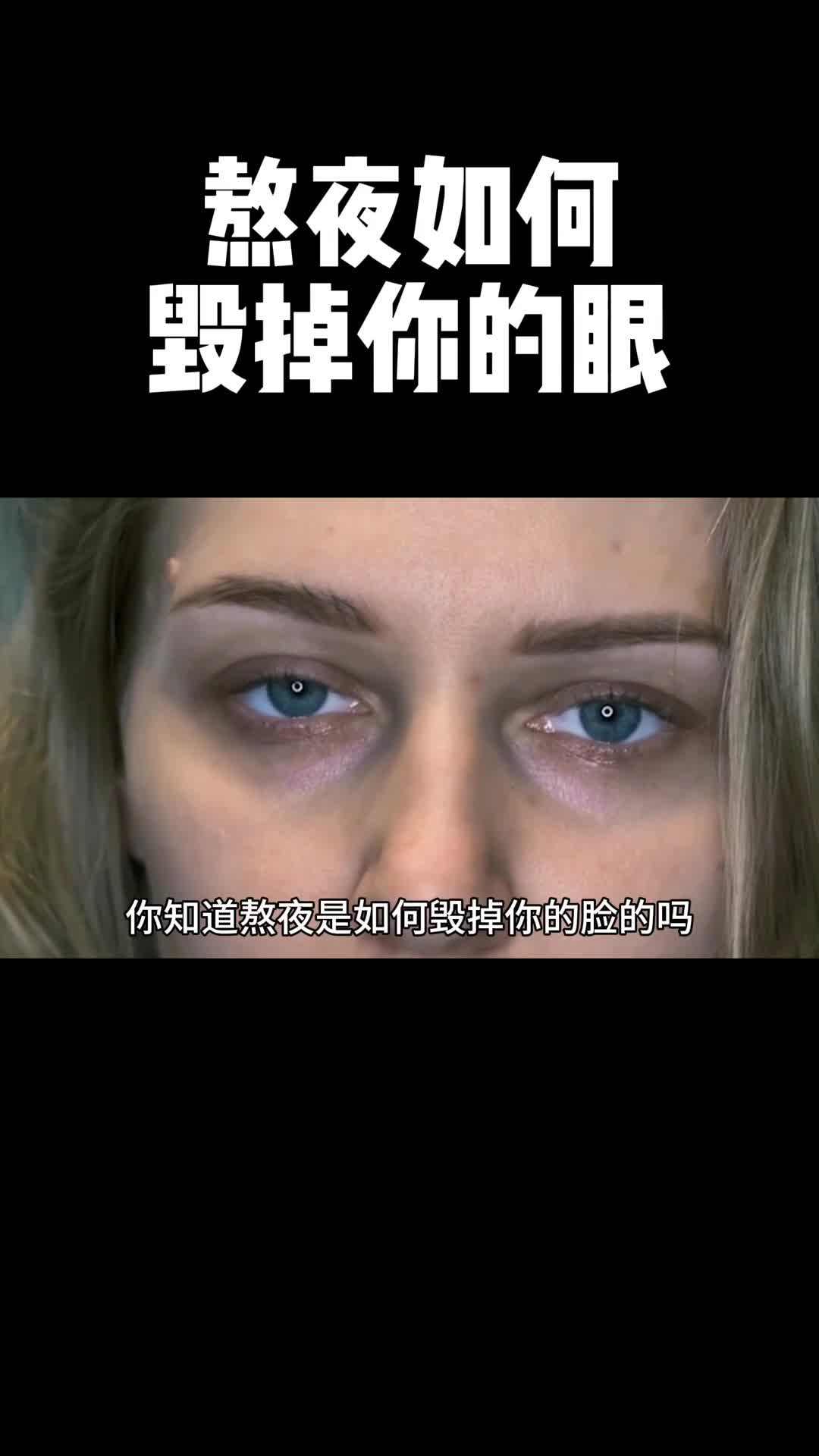 同样是熬夜为什么你的黑眼圈会越来越重