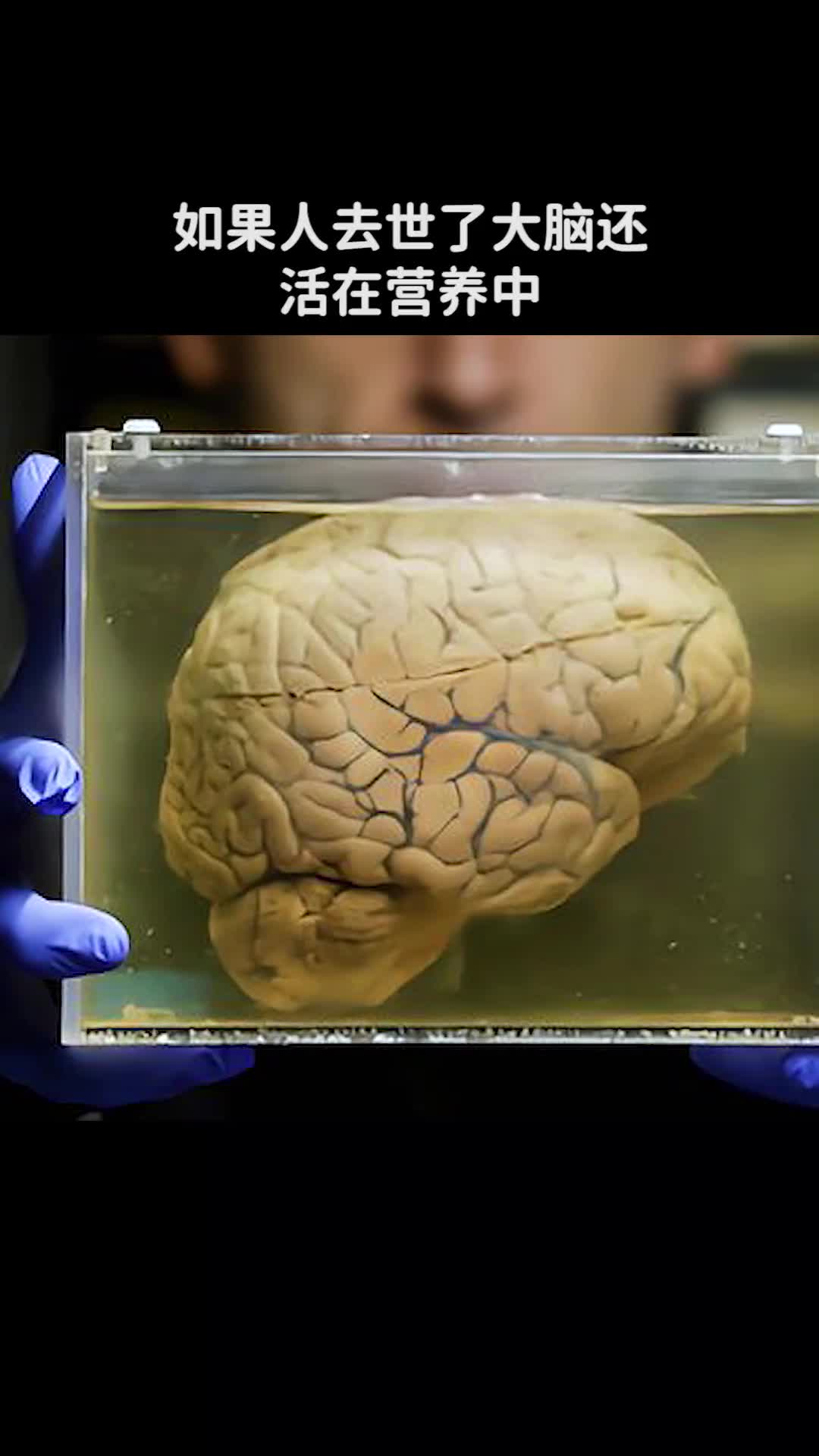 如果人去世了大脑还活在营养中那大脑还活在虚拟的世界里吗