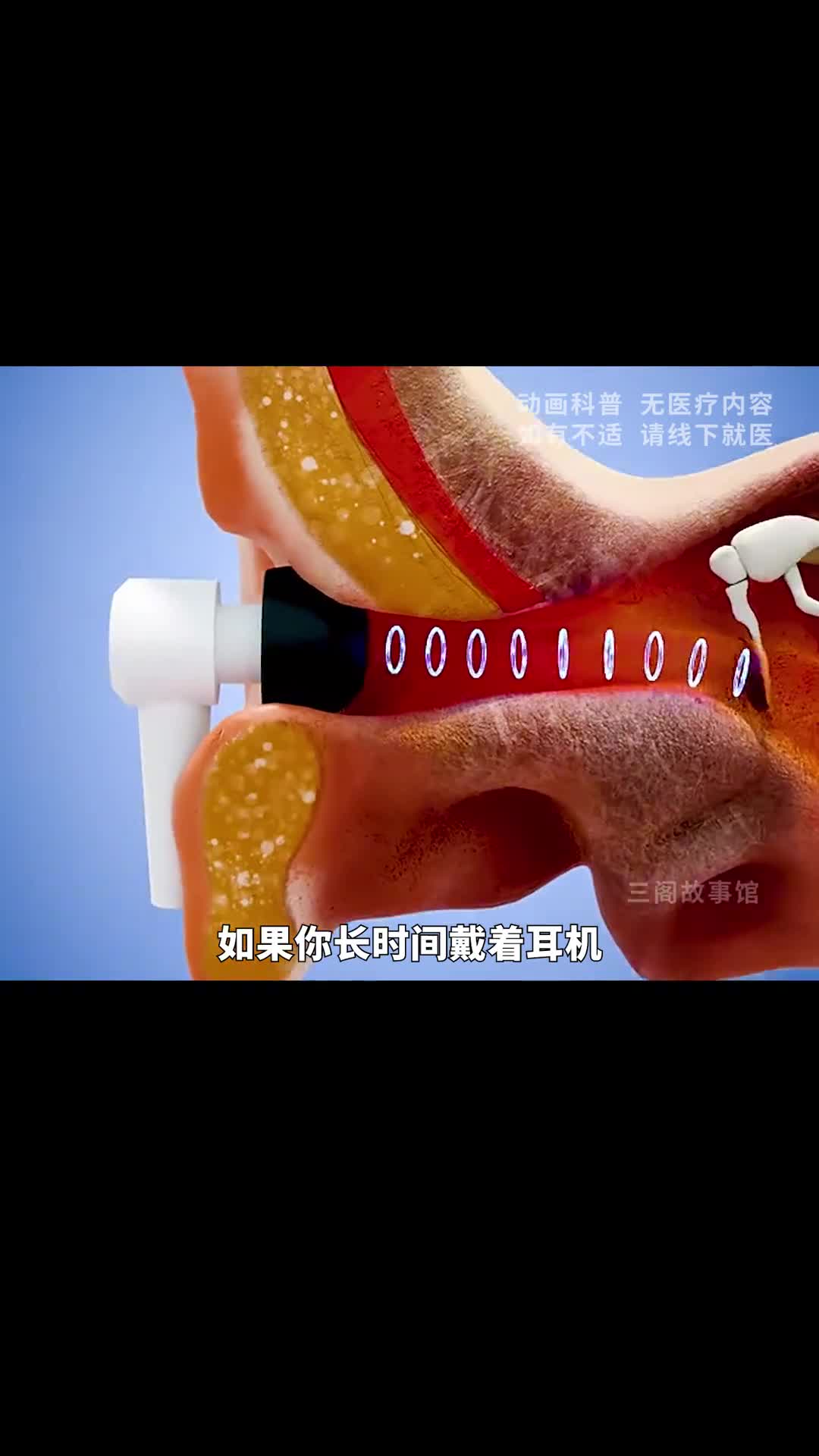 长时间戴耳机开大声可能会导致耳聋