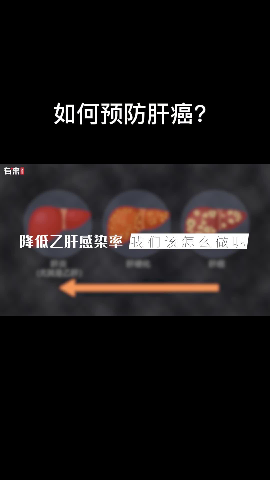 预防肝癌从生活中的小事做起