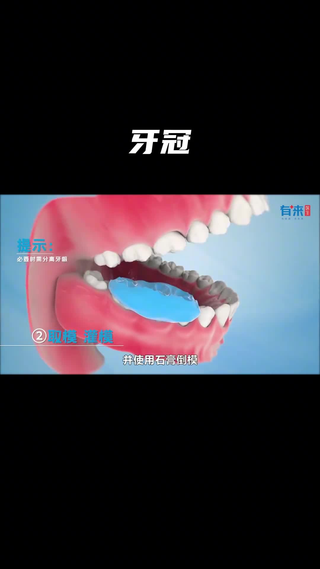 牙口不好的来看看