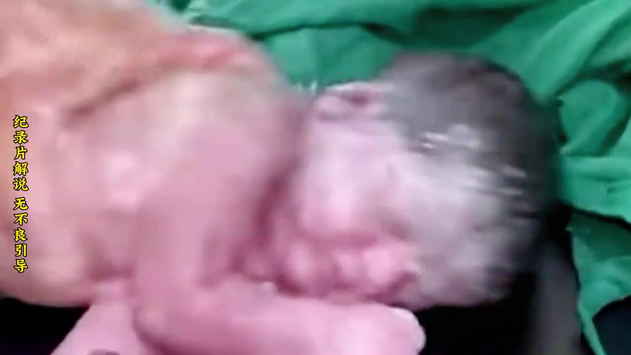 可怜的婴儿刚出生就没了呼吸和心跳十几名医生正在全力抢救