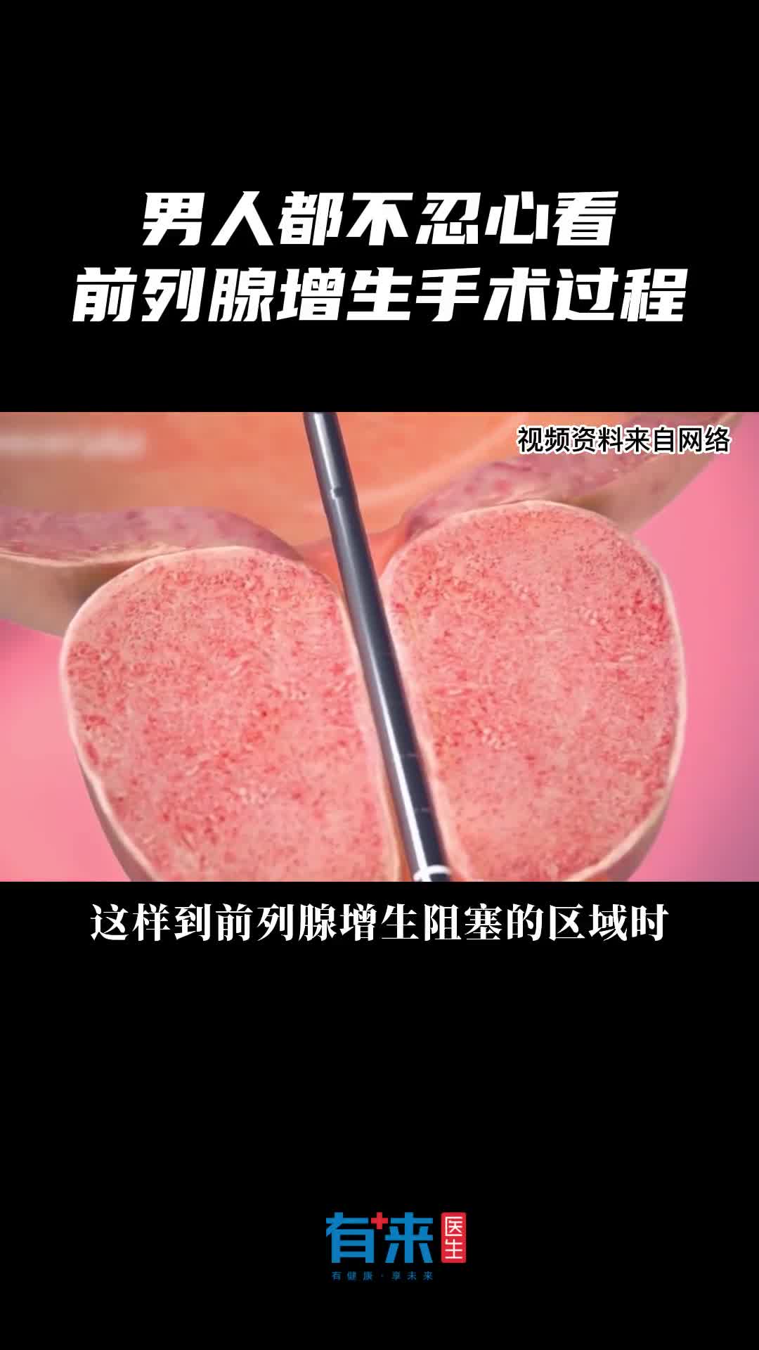 男人都不忍心看的手术过程