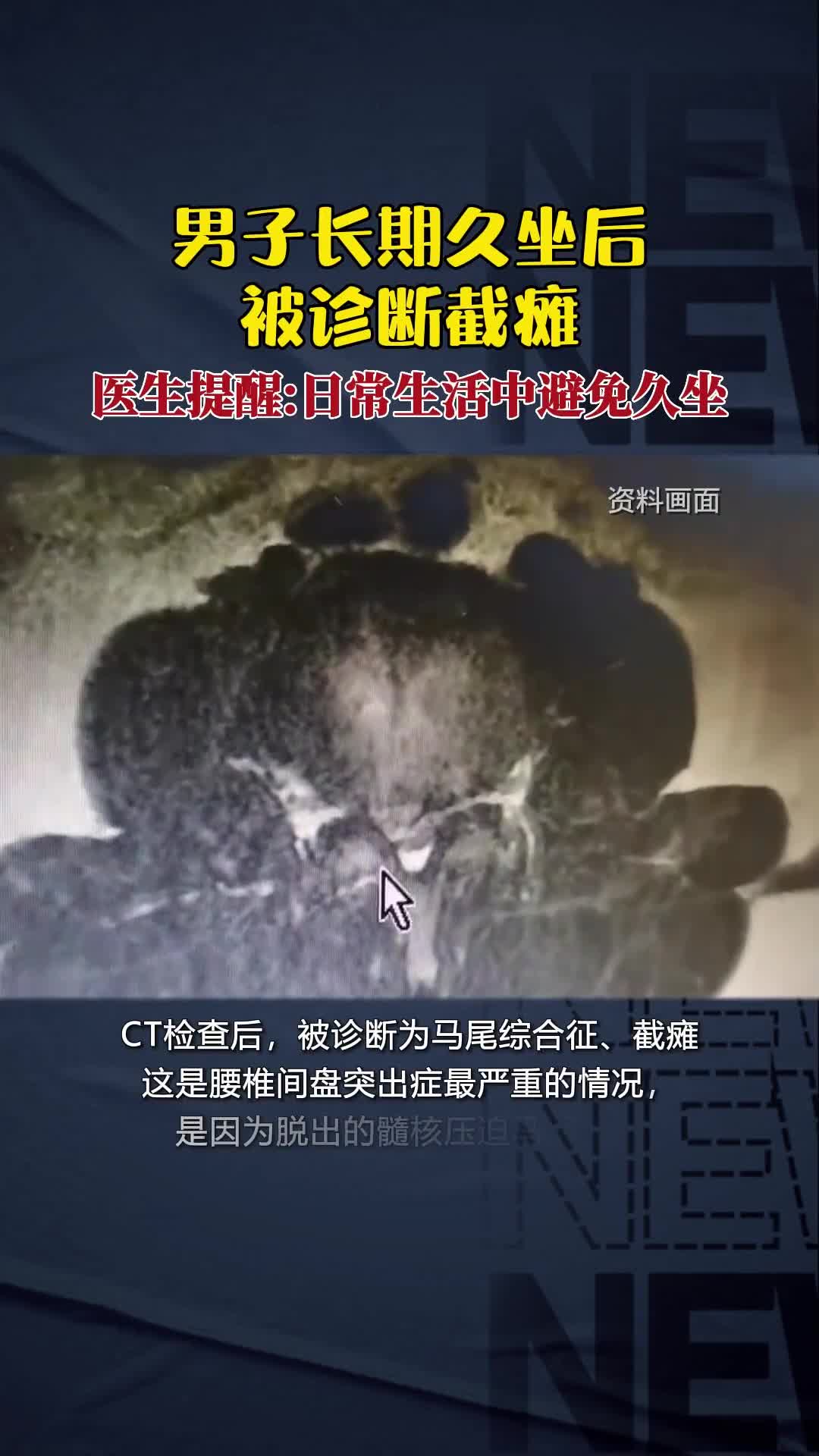 看到视频我赶紧站起来了