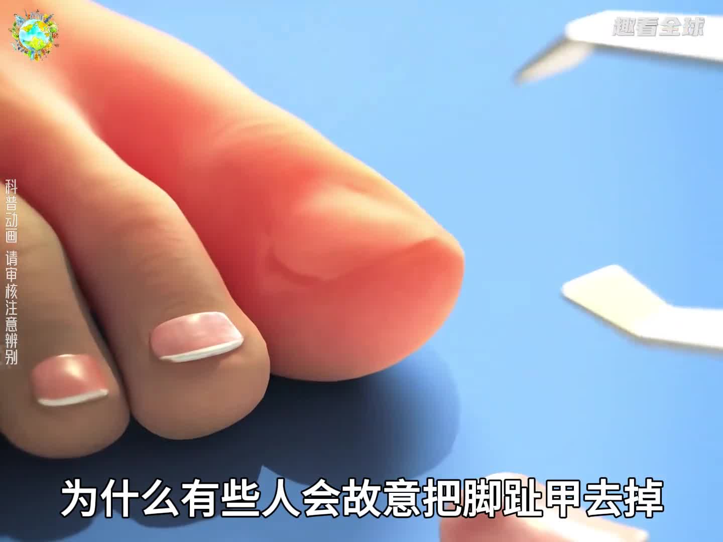 为什么有的人跑步要拔掉脚趾甲