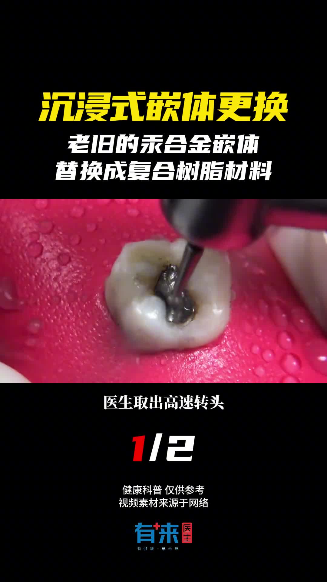 看完我的牙都酸了