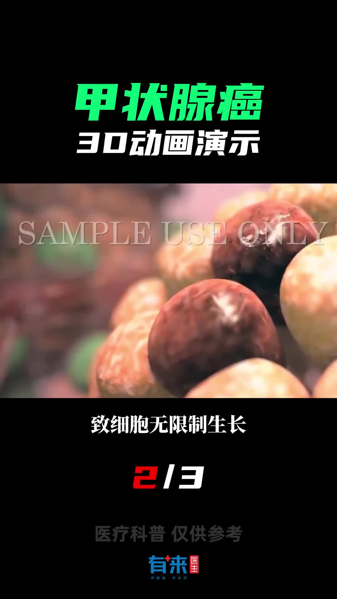 甲状腺健康不可忽视