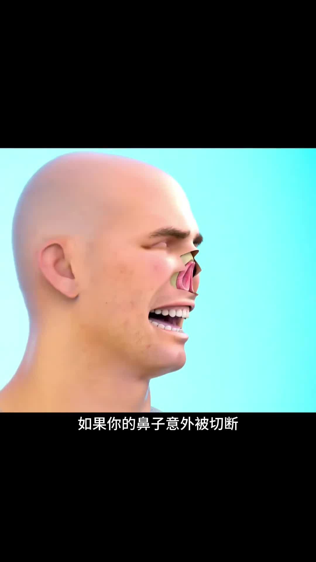 鼻子被切了不要慌