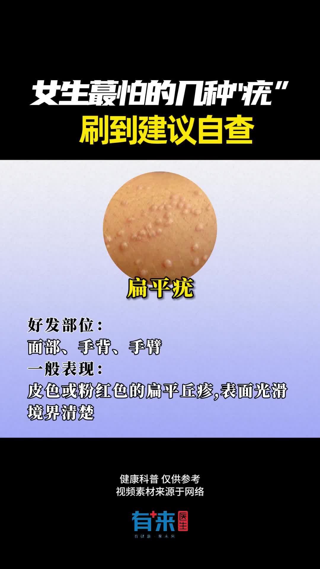 刷到建议自查下