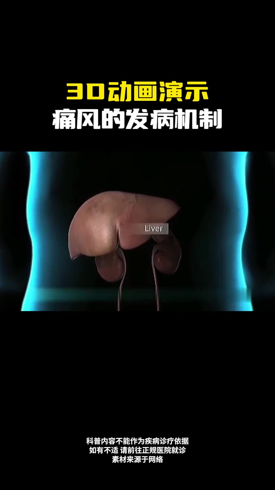 痛风的发病机制