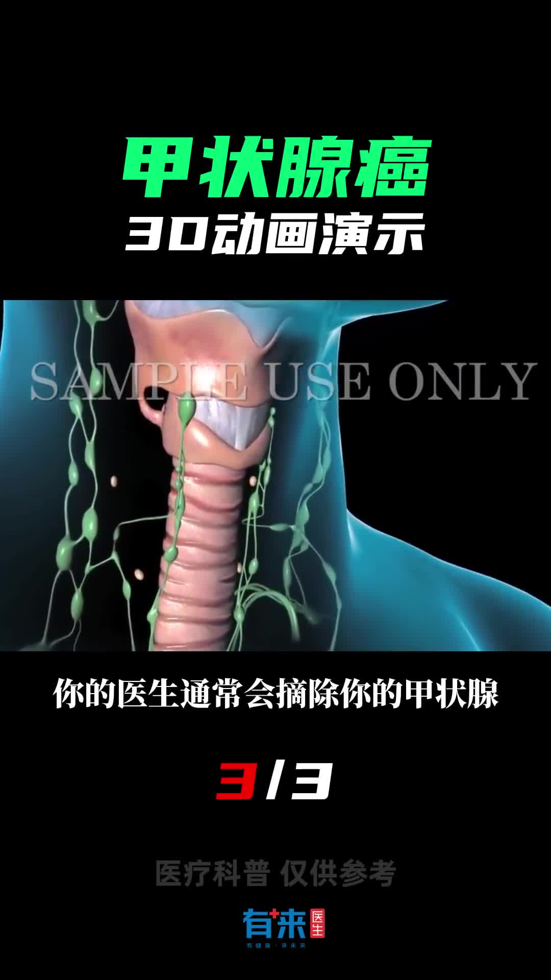 不要忽略甲状腺健康