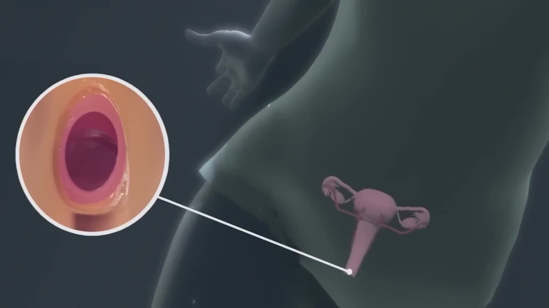 从科学的角度正确认识处女膜