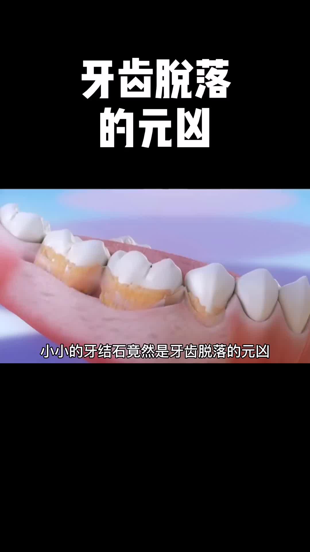 小小的牙菌斑竟然是牙齿脱落的元凶