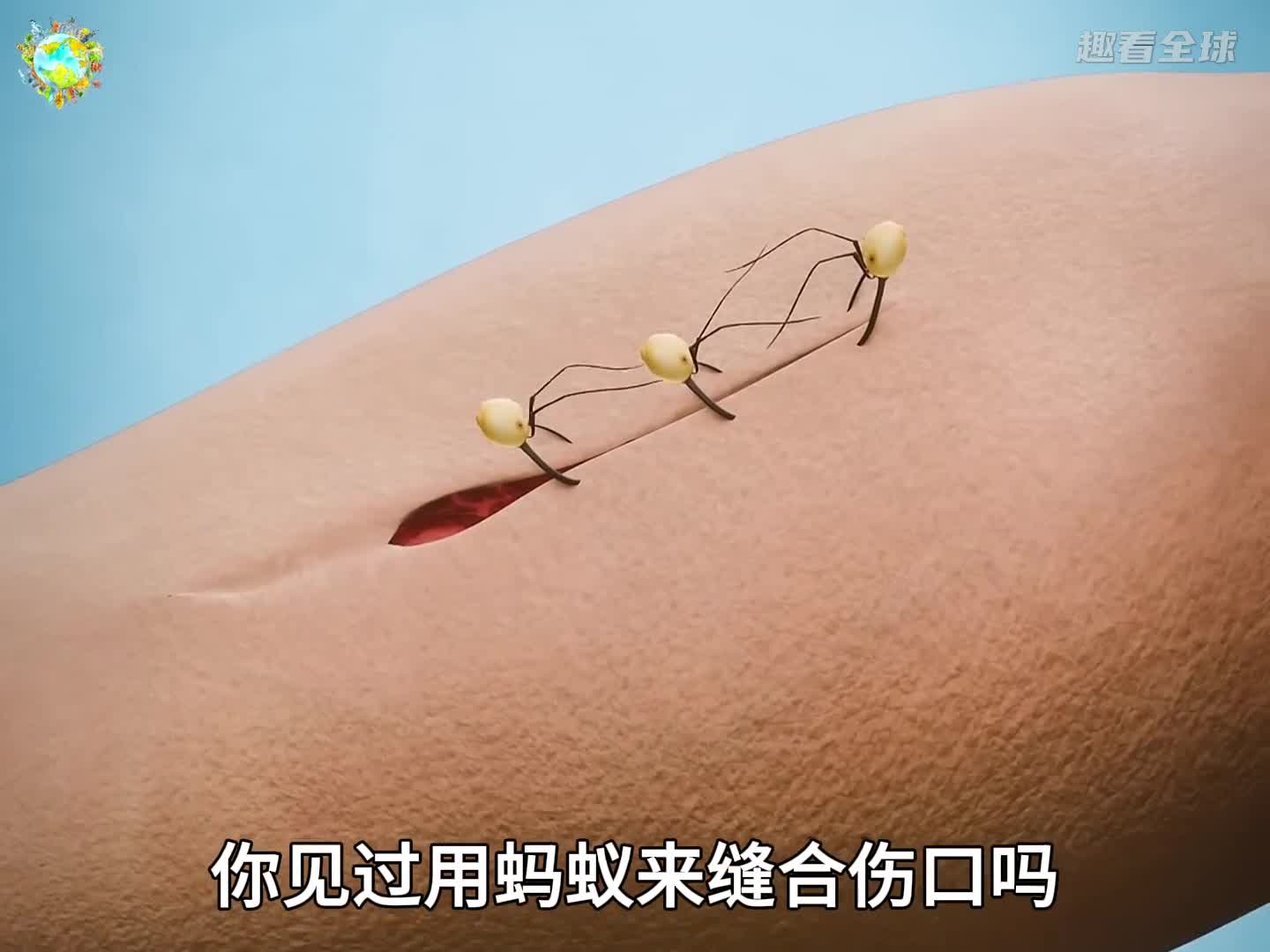 行军蚁怎样缝合伤口