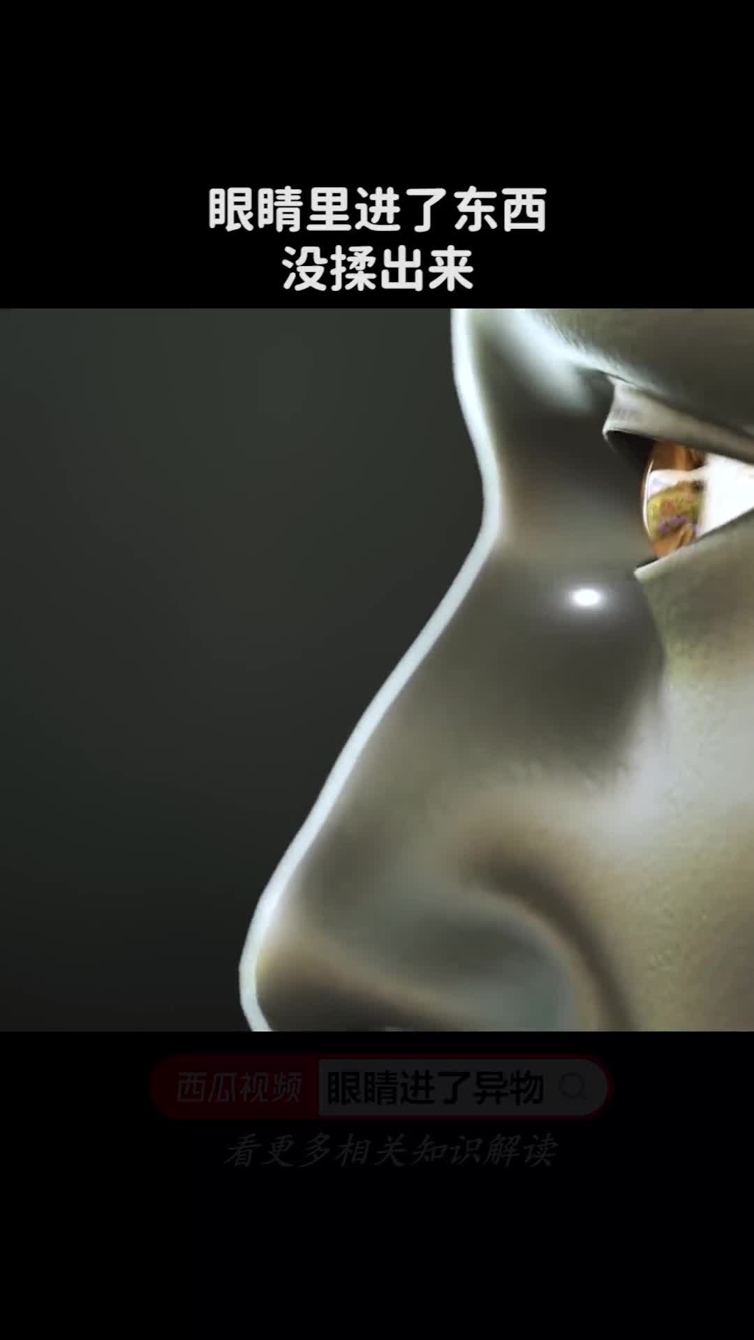 进了东西眼睛里的异物没揉出来那它去哪了呢