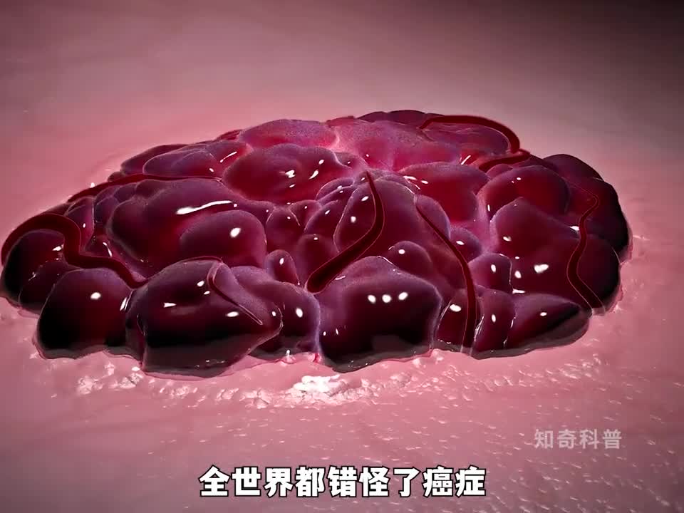 或许我们都错怪癌细胞了