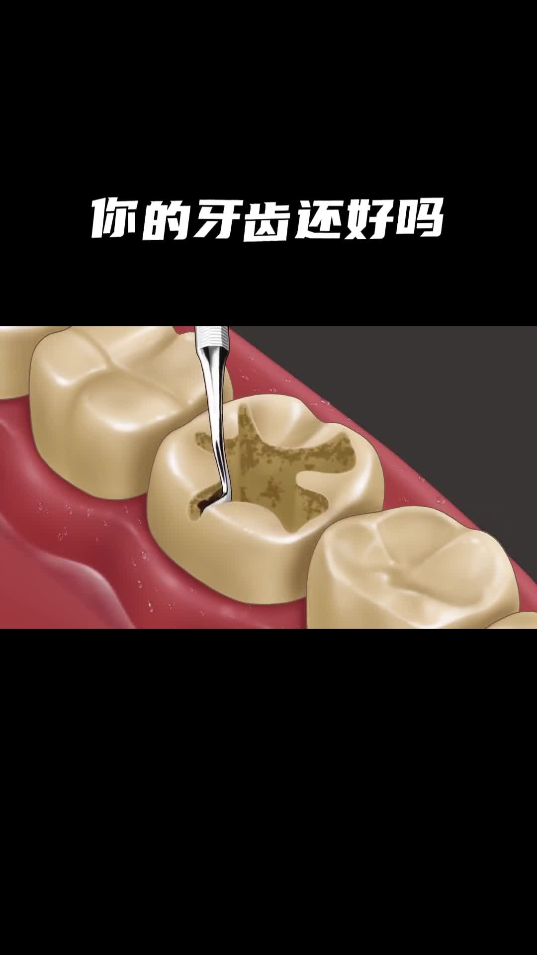 你的牙齿还好吗