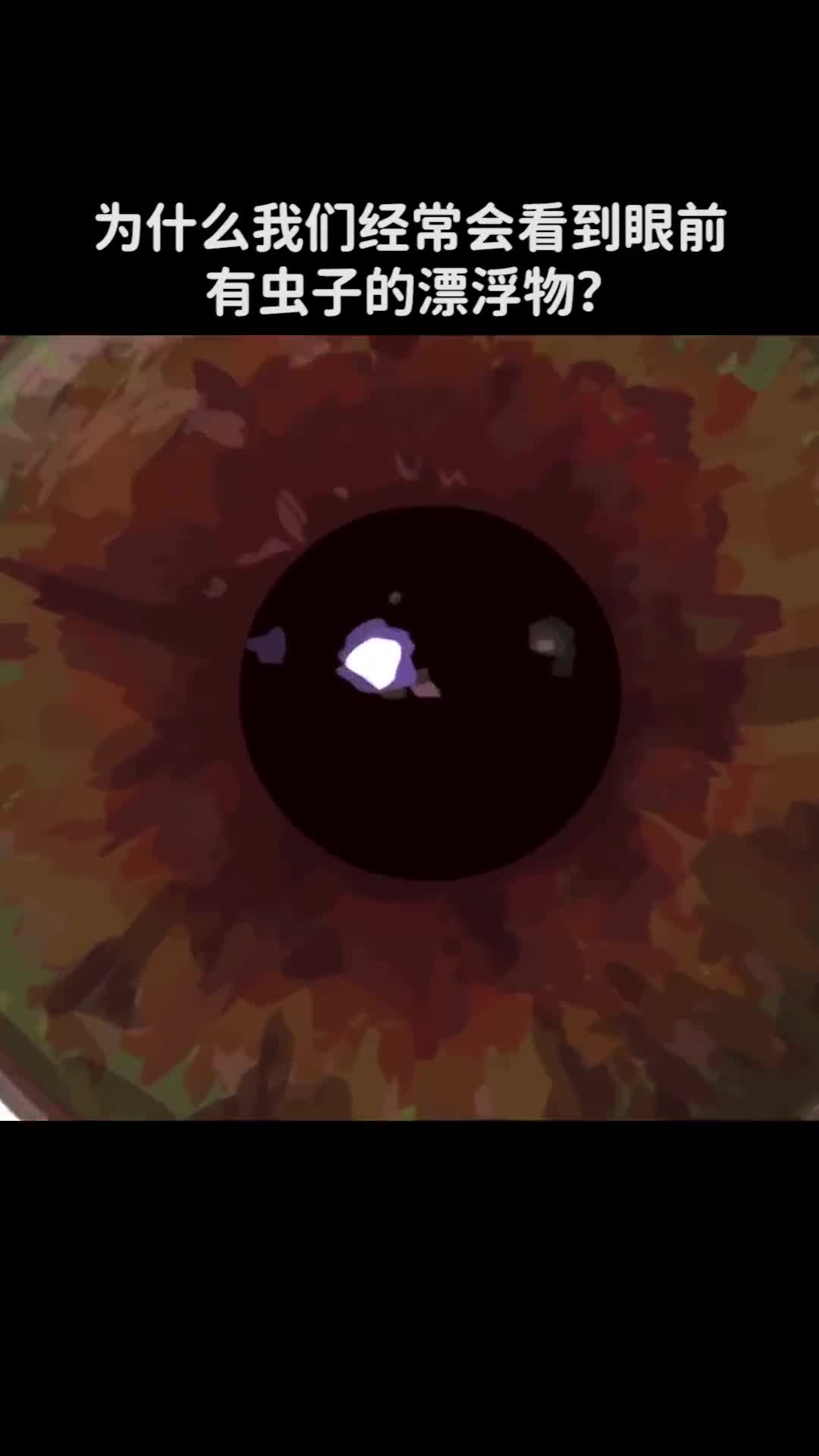为什么我们经常会看到眼前有虫子的漂浮物