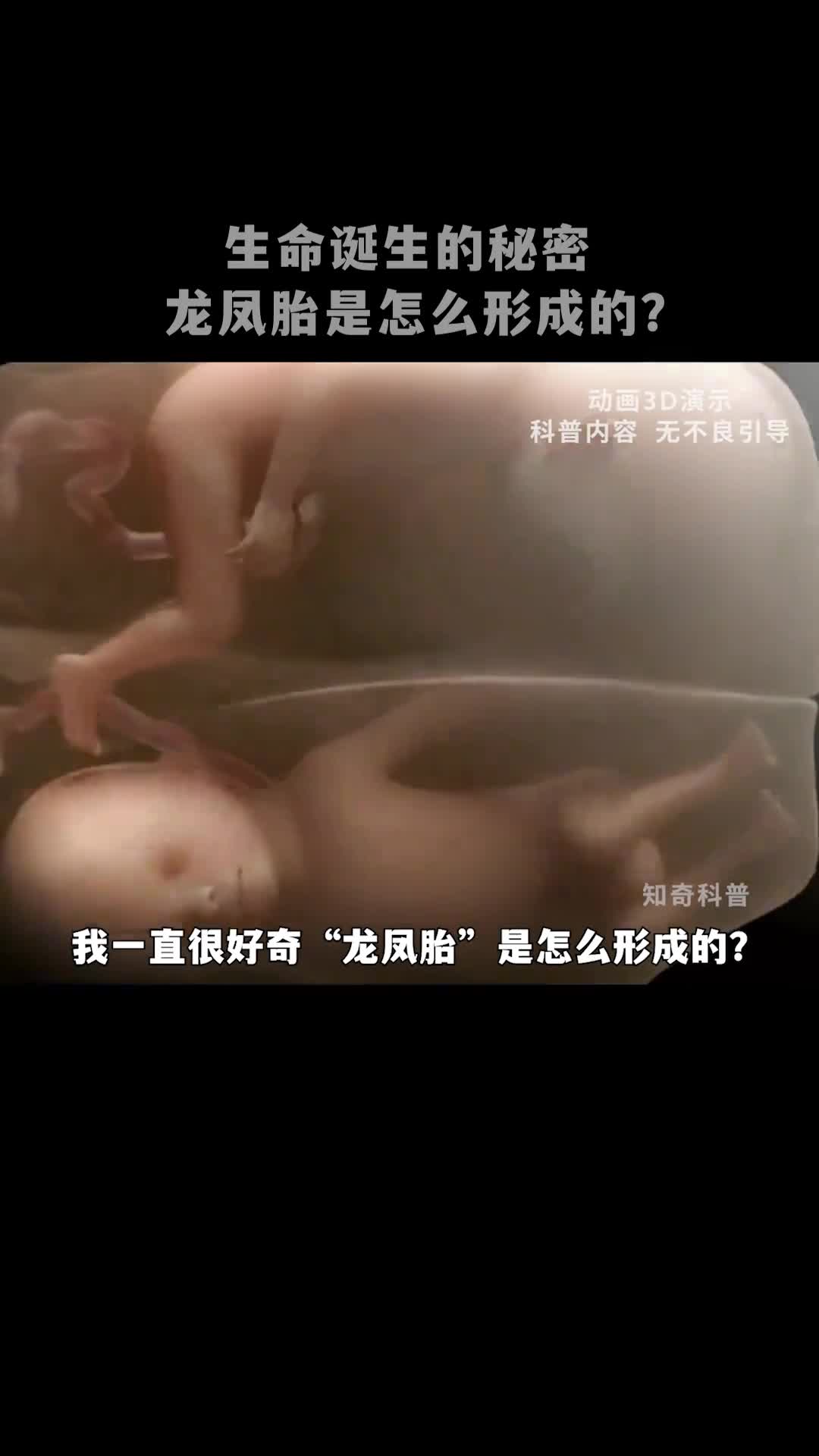 龙凤胎是怎么形成的