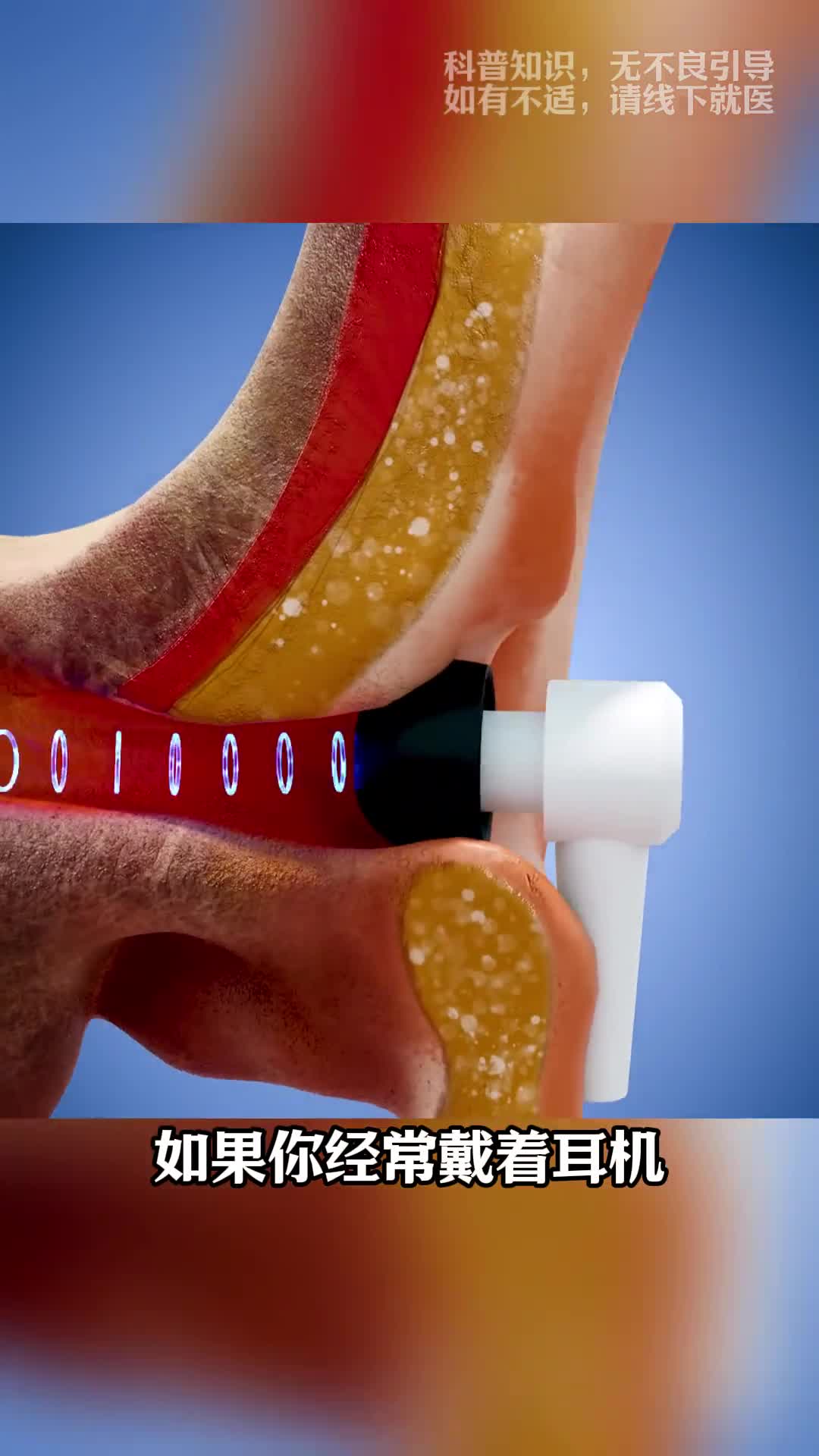 第92集丨耳机为什么会导致耳朵受损