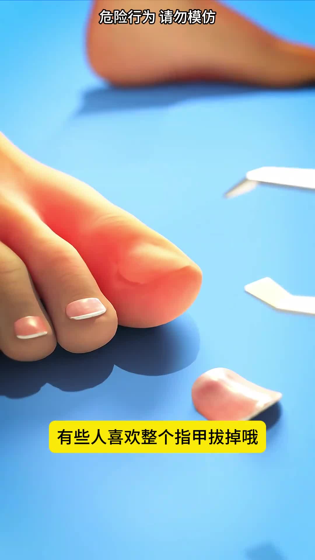 整个指甲拔掉他们为什么这样做