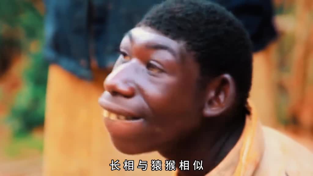 长相似猿猴擅长爬树遇事发出怪叫这样的猴孩你见过吗