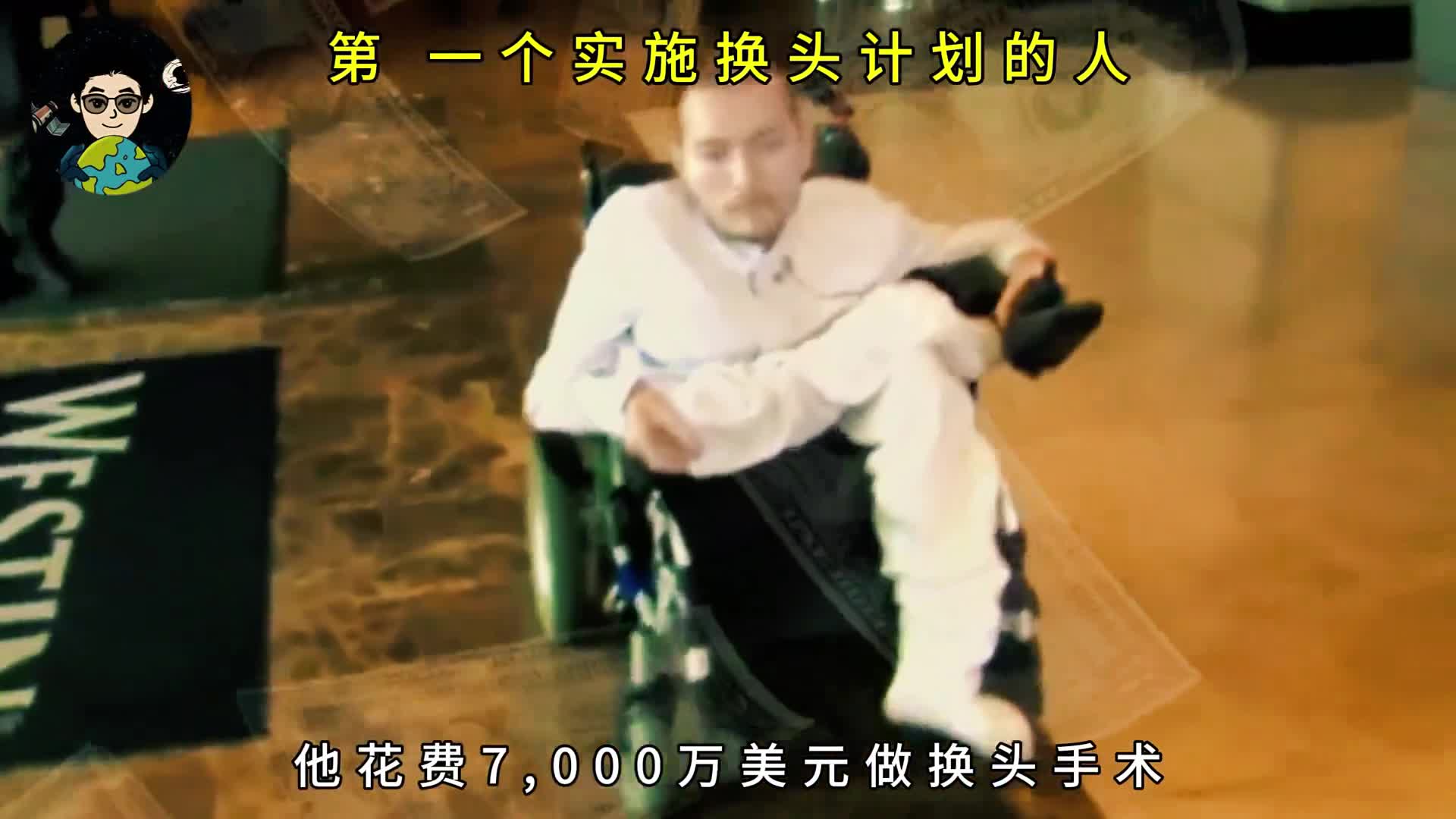 参加换头手术的33岁小伙现在怎样了