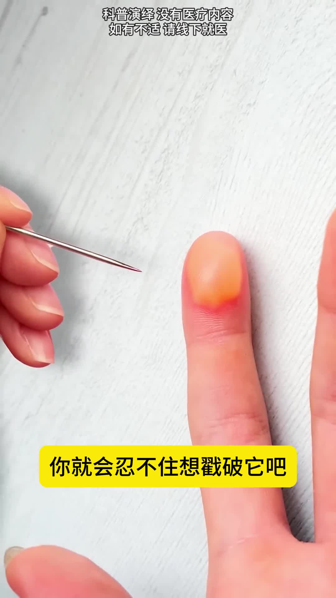 别再戳水泡了它的作用居然是